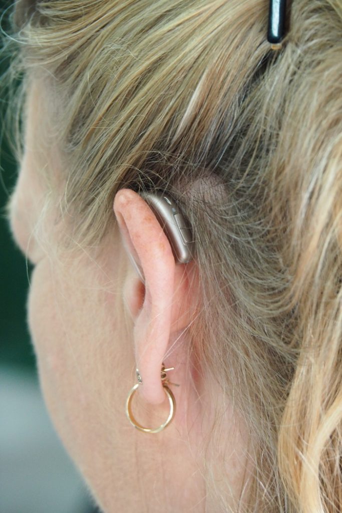 Ultimate Guide on Hearing Loss and Deafness Prevention and Treatment 